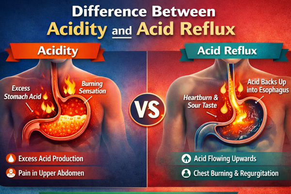 Difference Between Acidity And Acid Reflux - Explained By Expert